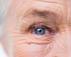 About Cataracts, Assil Eye Institute